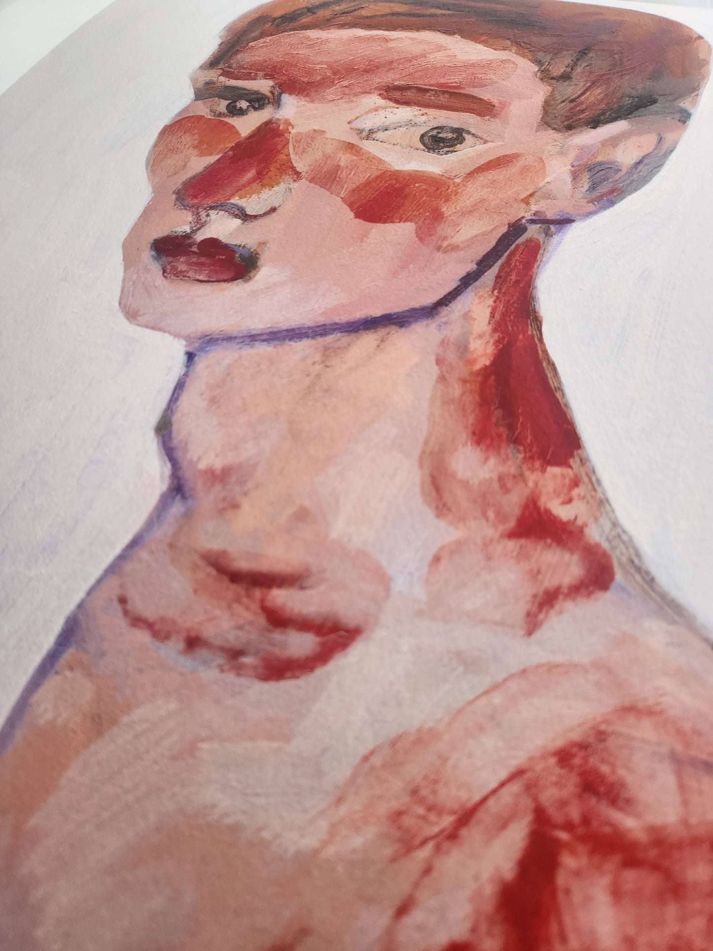 Sunburn - Ltd Edition Giclee